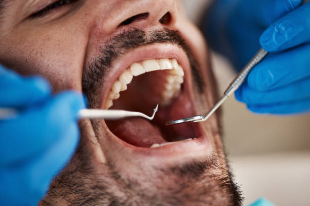Best Urgent Dental Care for Toothache in Halsey, OR