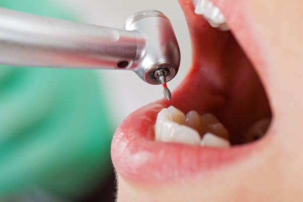 Best Weekend Emergency Dentist in Halsey, OR